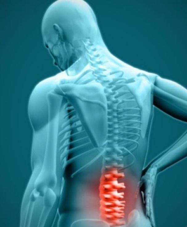 herniated disc 4
