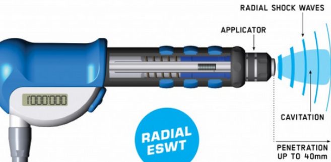 Radial shockwave applicator