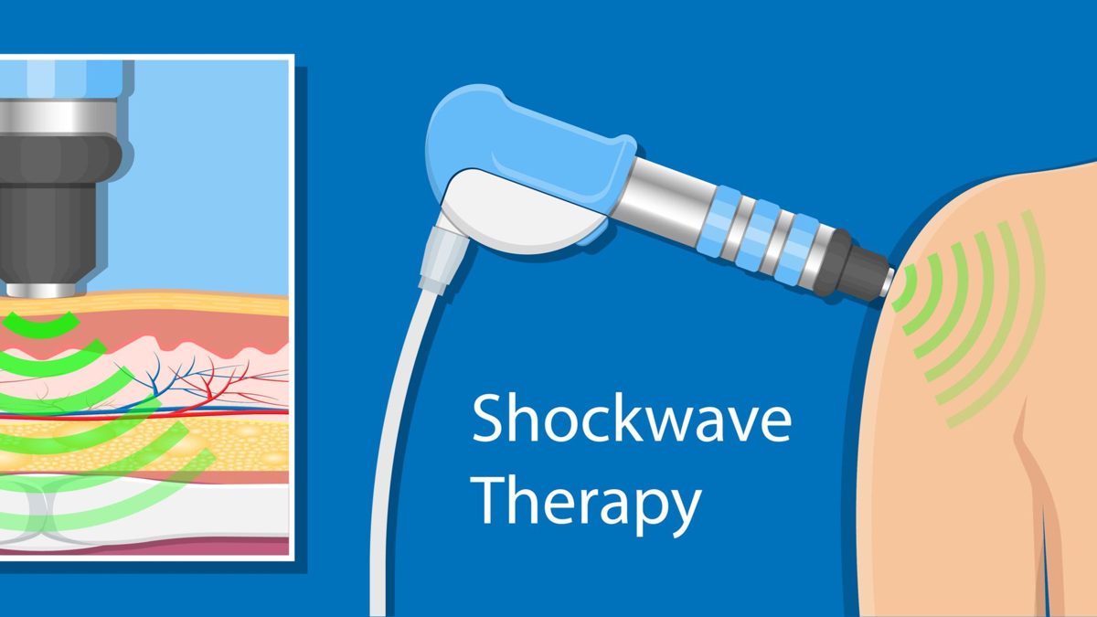 shockwave-therapy-how-it-works